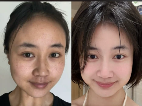 Bird's Nest Peptide online | Shaanxi BLOOM Tech Co., Ltd Bird's Nest Peptide online | Shaanxi BLOOM Tech Co., Ltd